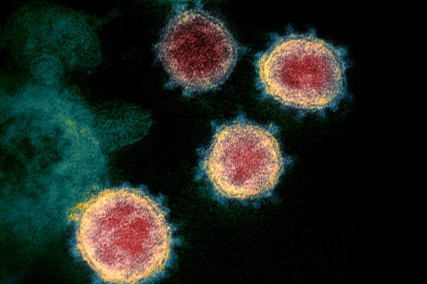 coronavirus-covid-19-sars-cov-2-feb-2020-600×400